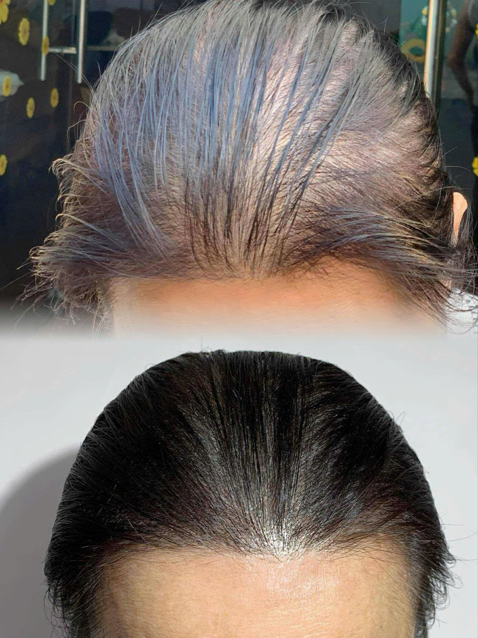Simulates hair on scalp for fuller look.